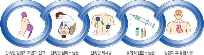 1.신속한 심정지 확인과 신고, 2.신속한 심폐소생술, 3.신속한 제세동, 4.효과적 전문소생술, 5.심정지 후 통합치료